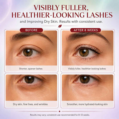 Castor Oil for lashes and dark circles