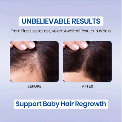 rosemary oil for hair growth before and after